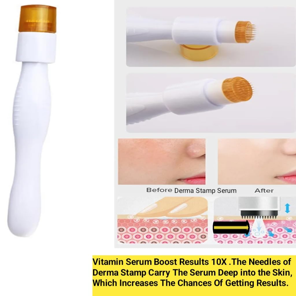 Myora 1.5mm Titanium Derma Roller for Face & Scalp – Professional Microneedling Stamp for Anti-Aging, Acne Scars, Pore Minimization & Hair Growth – At-Home Skin Care Treatment for Women & Men – Perfect for DIY Facial Rejuvenation & Beard Enhancement
