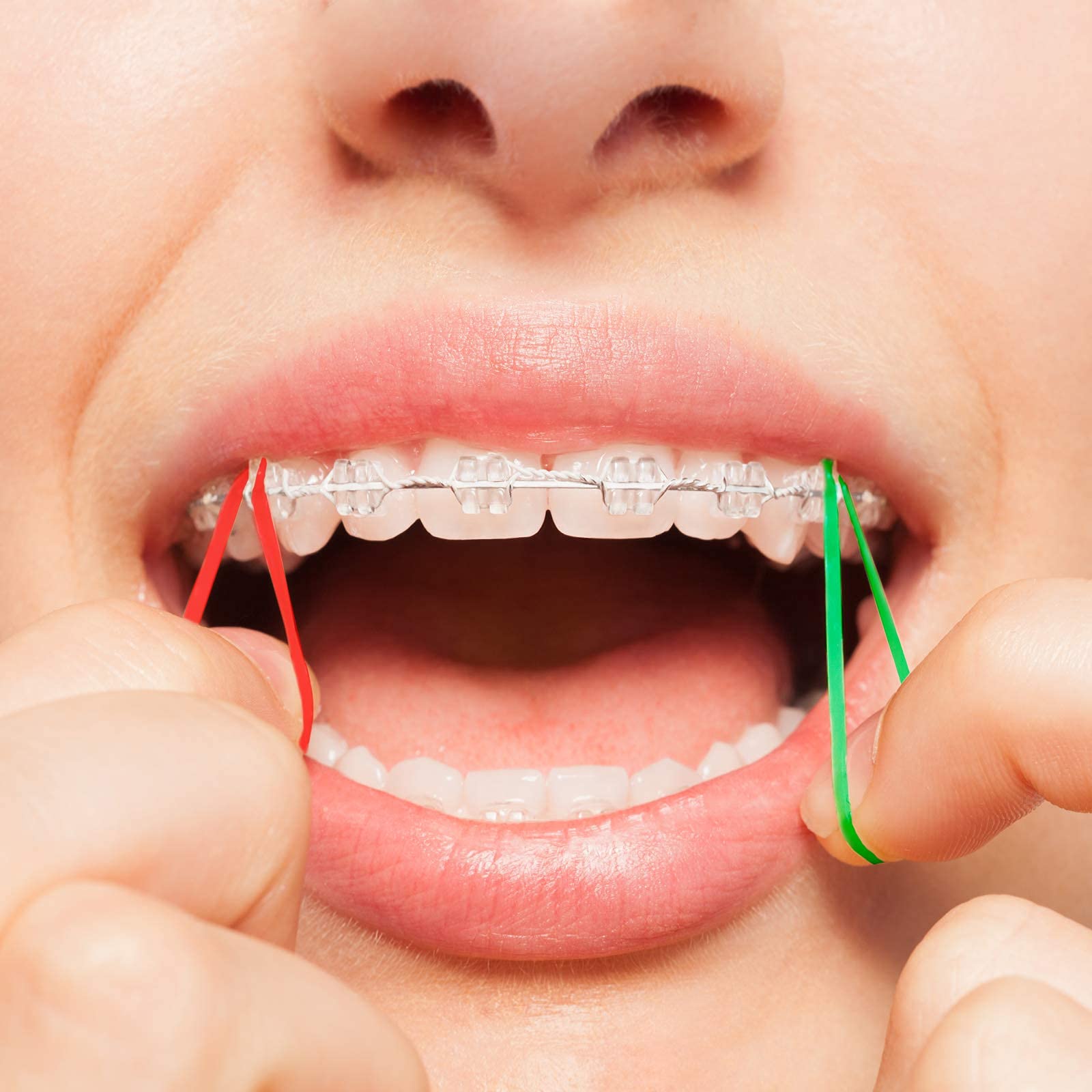 JMU Orthodontic Elastics 5/16 Medium - 500 Pack Latex-Free Neon Intraoral Rubber Bands for Braces | Made in USA | Perfect for Teeth Alignment & Orthodontic Treatment