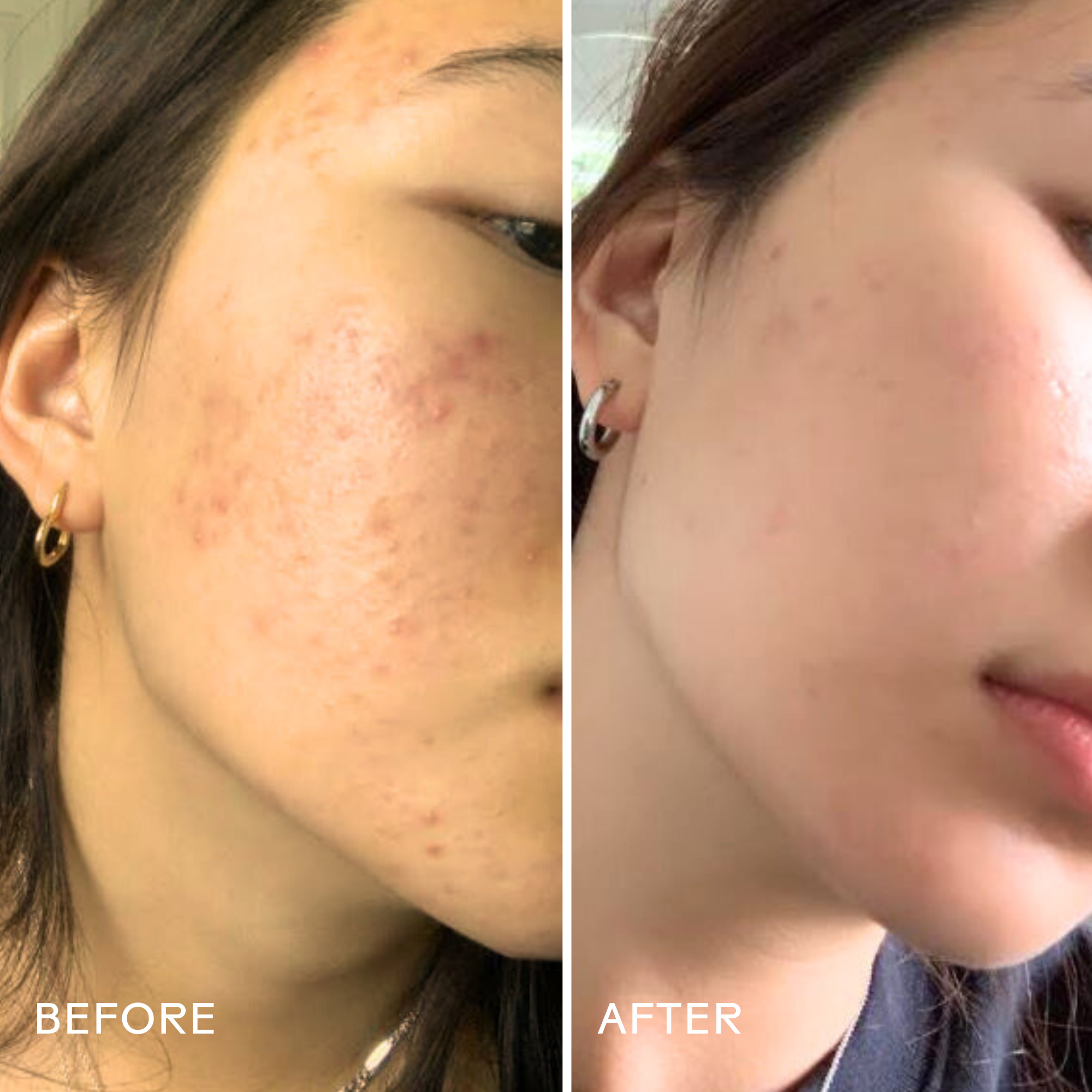Purify Aloe Vera & Amino Acid Facial Cleanser - Gentle Foaming Face Wash for Acne, Oily & Sensitive Skin - Hydrating & Soothing Daily Skincare Routine