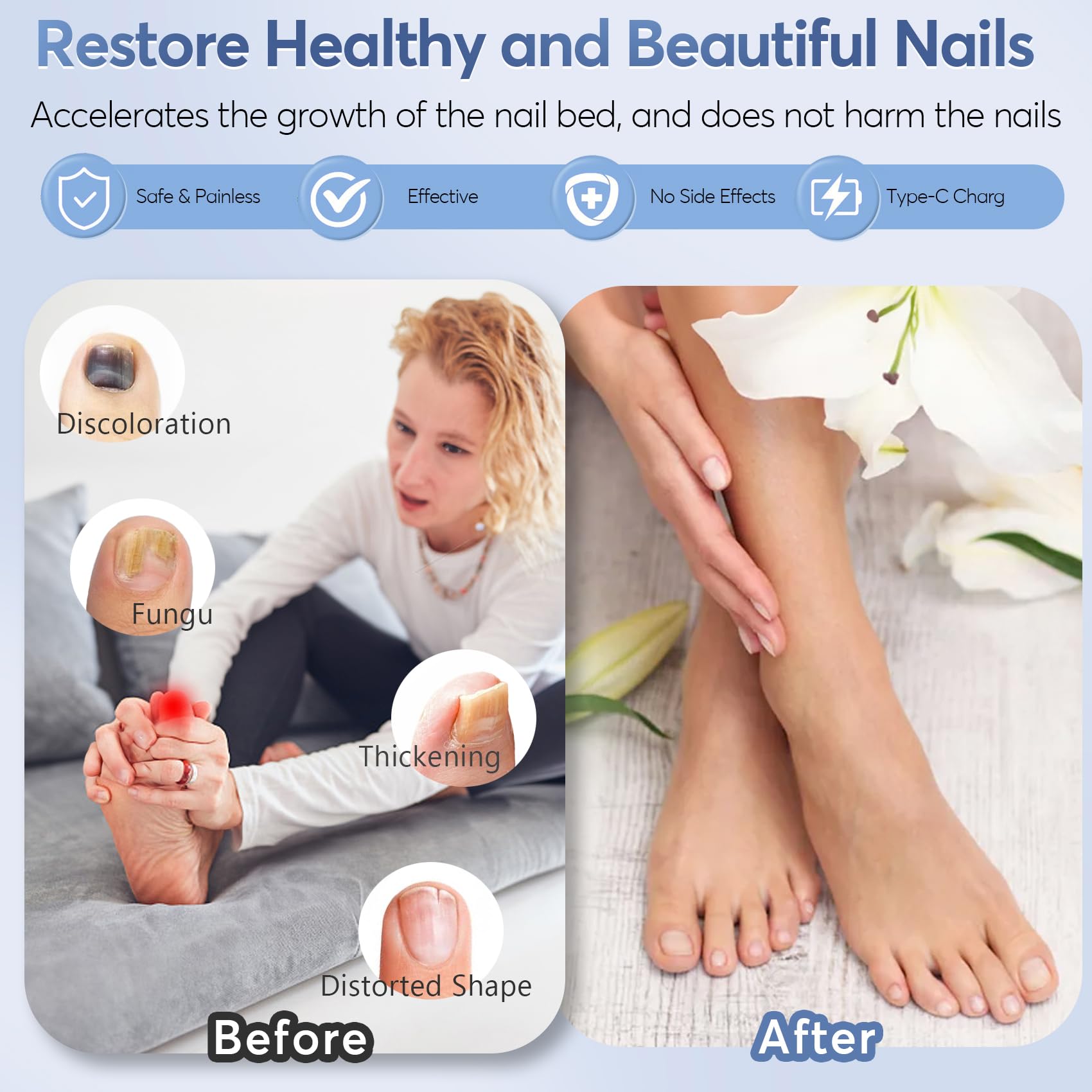 Best Nail Fungus Laser Treatment Device - LED Light Therapy for Toenail & Fingernail Fungal Infections | Improves Nail Health, Reduces Deformation & Pain | Portable Home Use for Athletes, Seniors & Diabetics (Black)