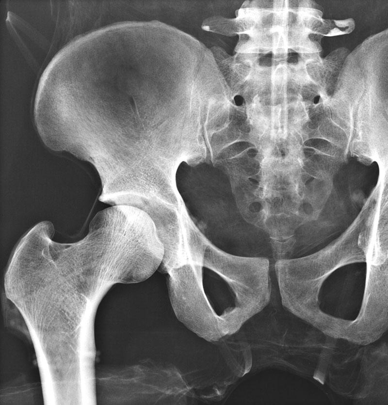 Full Body X-Ray Phantom with Real Human Skeleton Bones - High-Quality Medical Training Model for Radiology, Anatomy Studies & X-Ray Positioning Practice (Ideal for Medical Schools, Hospitals & Research Labs)