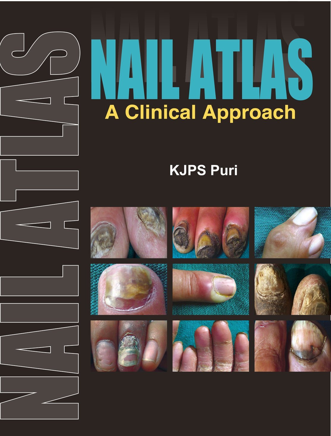 Nail Atlas: Clinical Guide for Nail Disorders | Diagnosis & Treatment Reference for Dermatologists & Podiatrists | Perfect for Medical Students & Professionals