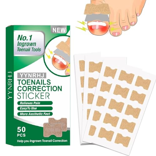 **50 Pcs Ingrown Toenail Corrector Patches - No Glue, Breathable & Painless Nail Correction Tool for Fast Repair, Stays Secure & Won’t Fall Off - Ideal for Ingrown Toenail Treatment & Daily Comfort**