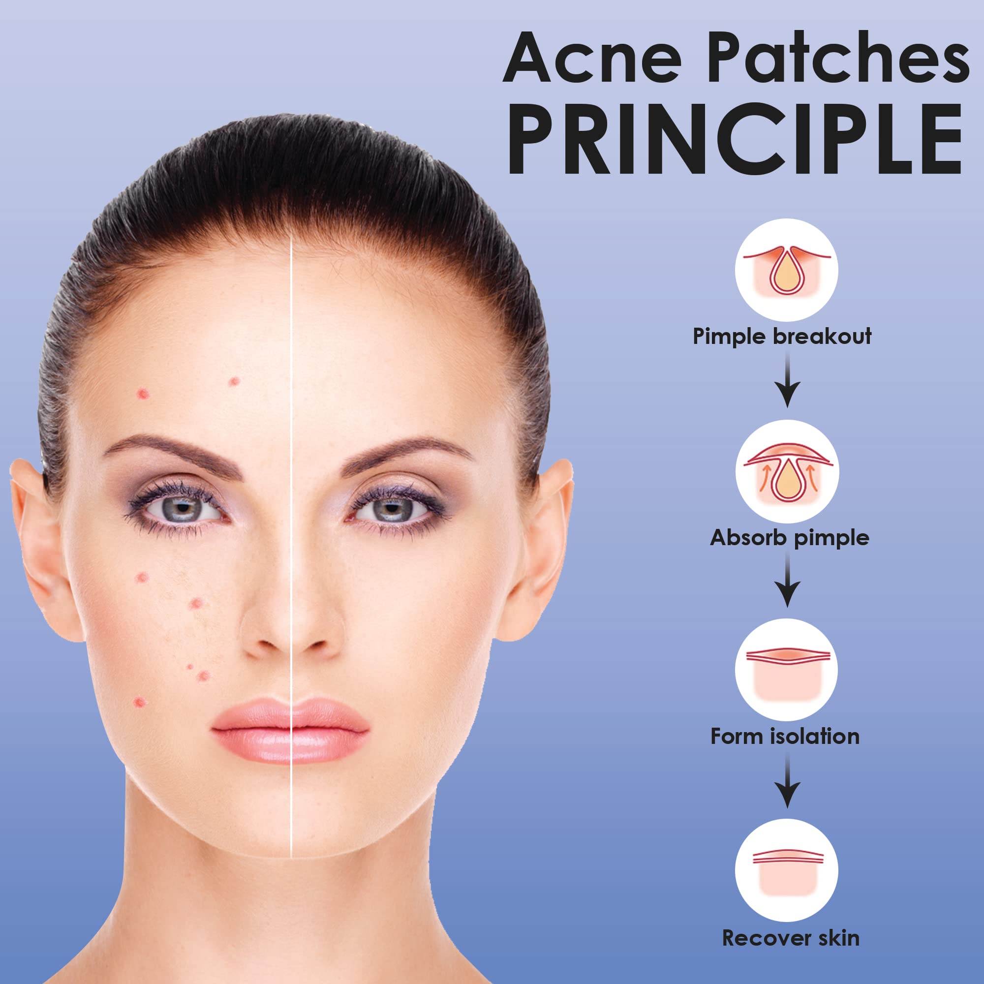 VOIISH Acne Pimple Patch - 100% Hydrocolloid Facial Stickers for Zit & Blemish Treatment, Invisible Pimple Patches for Spot Healing (Pack of 1) - Perfect for Overnight Acne Care & Makeup Prep