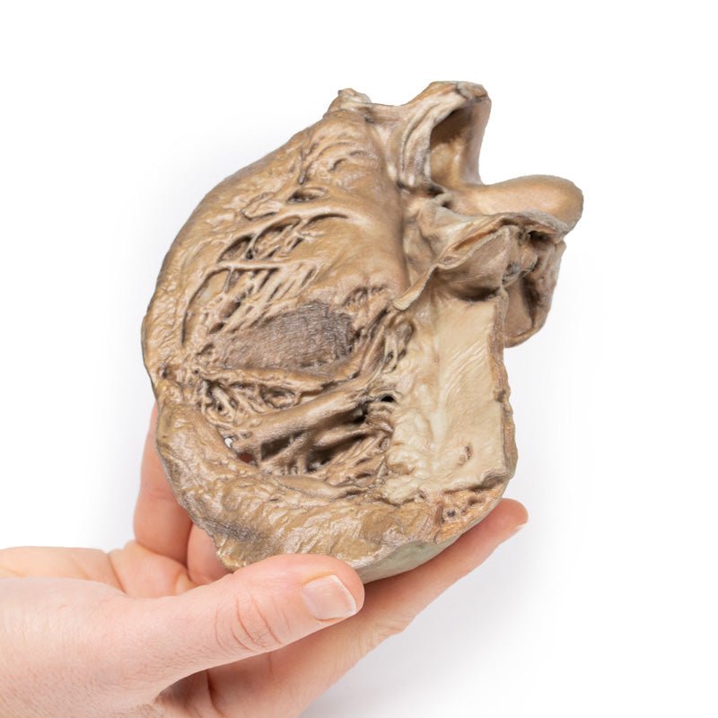 3D Printed Biscupid Aortic Valve - High Precision Medical Heart Valve Replacement for Cardiovascular Surgery - Ideal for Surgeons, Hospitals & Medical Training