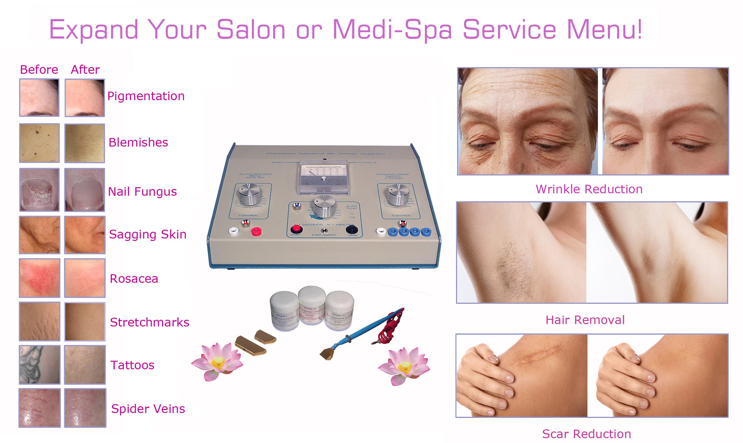 Professional MediSpa Equipment Skincare Package for Hair, Vein, Nail Fungus, Scar & Wrinkle Treatment | Pigment Reduction, Skin Toning & Rejuvenation | Perfect for Clinics, Spas & Home Use