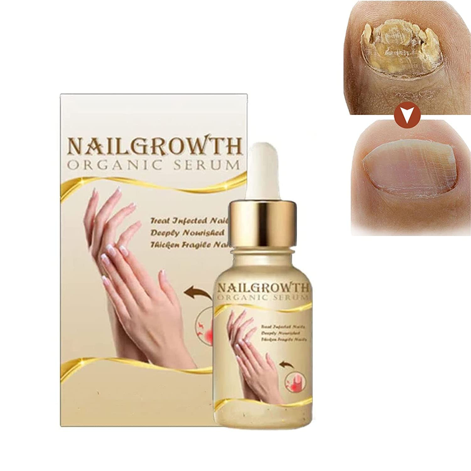 Organic Nail Growth Serum - Deep Healing & Strengthening Treatment for Stronger Nails in 7 Days | Natural Nail Care Solution for Damaged, Weak, or Brittle Nails | Perfect for At-Home Manicures & Nail Repair (1 Pack)