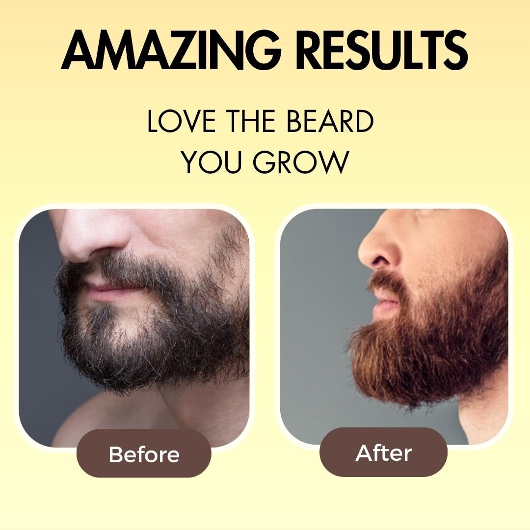 Natural Beard & Brow Growth Oil for Men & Women - Herbal Formula with Almond, Jojoba & Virgin Coconut Oil - Stimulates Fast Hair Growth for Patchy & Uneven Areas - 10ml - Perfect for Daily Grooming & Thicker Facial Hair Care