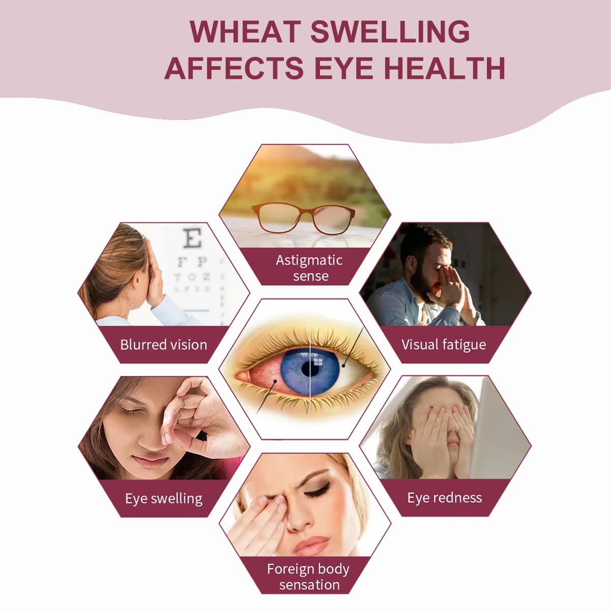 Eye Stye Remover & Treatment for Styes, Chalazion & Blepharitis - Fast Relief Gentle Lash & Eye Cleanser | Perfect for Daily Eye Hygiene & Eyelid Care