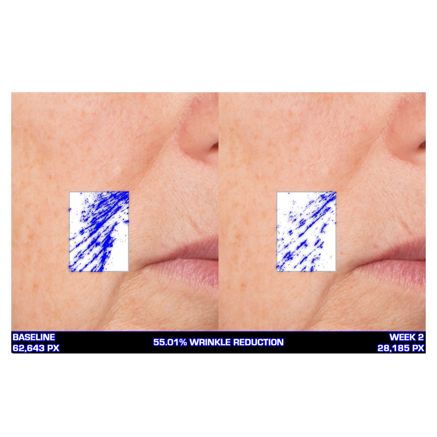 Serious Skincare Ultra-Mare Pure Marine Infusion Facial Serum - Collagen Boosting, Cell Renewal & Plumping Serum with Niacinamide, Acid-Free Formula (2 oz) - Perfect for Nighttime Skincare Routine & Anti-Aging Regimen