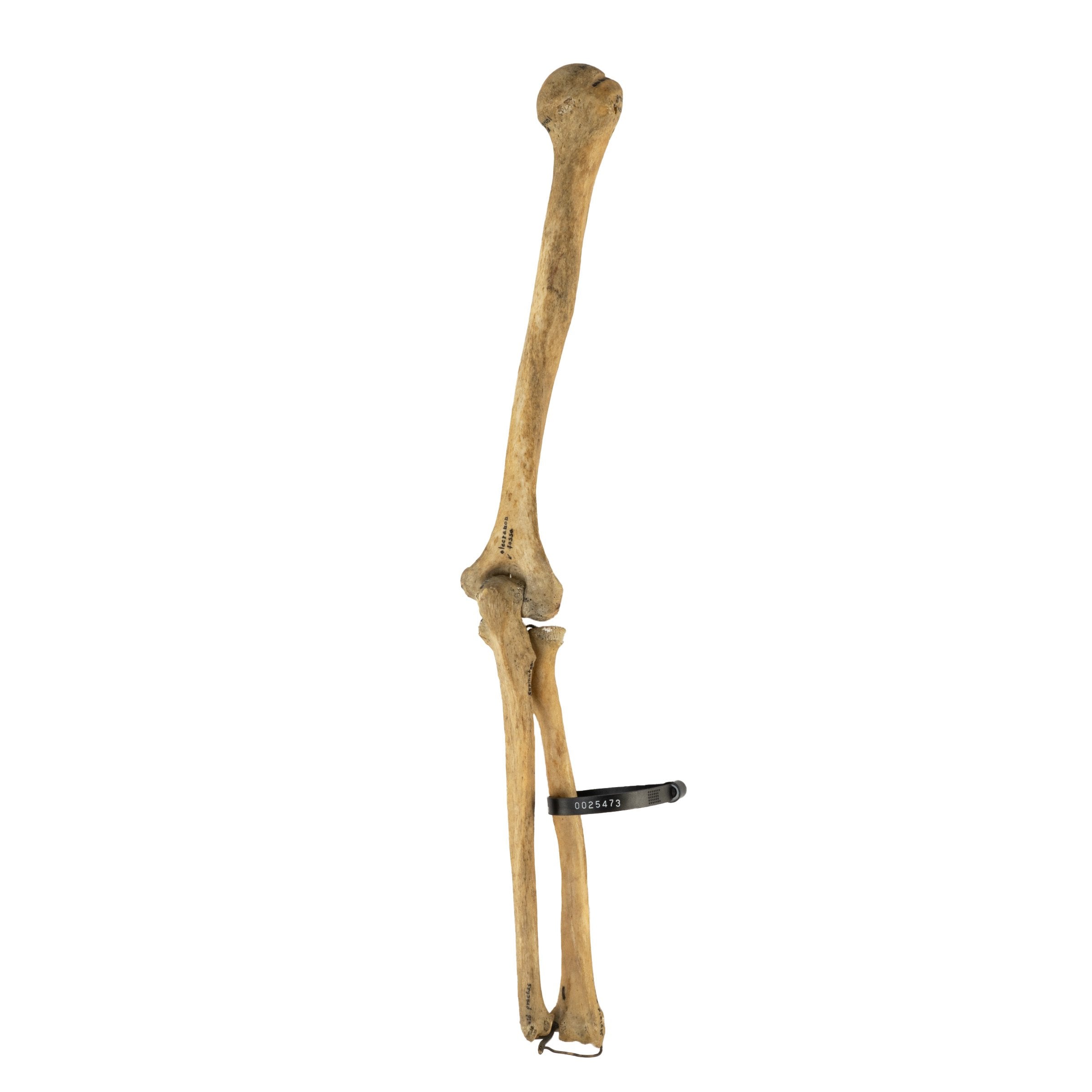 Authentic Human Humerus, Radius & Ulna Bones - Medical Study, Anatomy Education & Science Classroom Specimen
