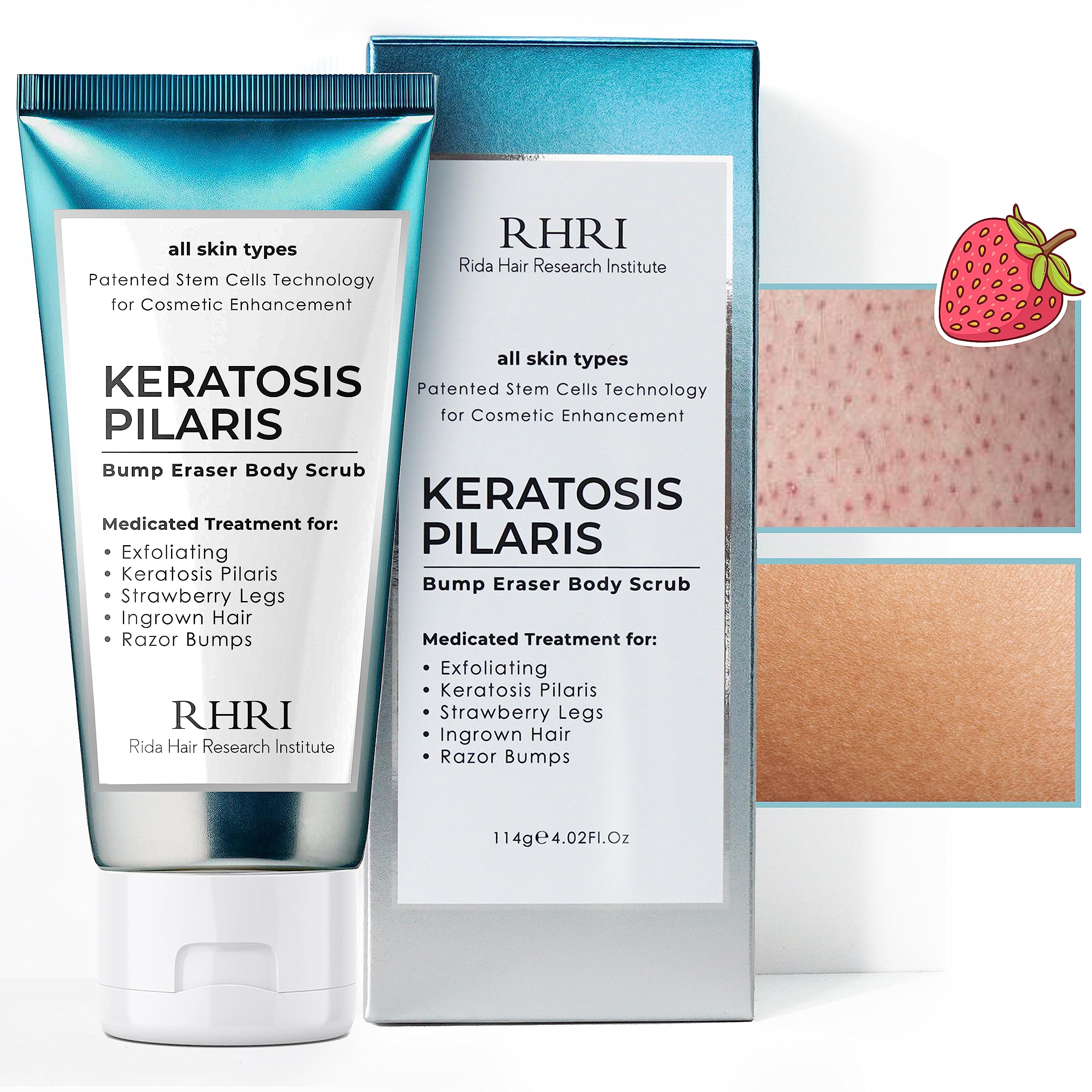 KP Bump Eraser Body Scrub - Exfoliating Treatment for Keratosis Pilaris & Strawberry Legs - Smoothing Body Scrub for Women - Perfect for Dry Skin & Ingrown Hair Care - Use After Shaving or Before Moisturizing
