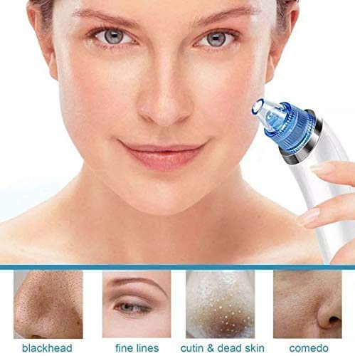 UCRAVO Blackhead Remover Vacuum Machine - Pore Cleaner & Pimple Extractor Tool for Women & Men | Facial Skin Care Device for Blackhead Removal & Deep Cleansing | Perfect for Daily Skincare Routine & Spa Treatments
