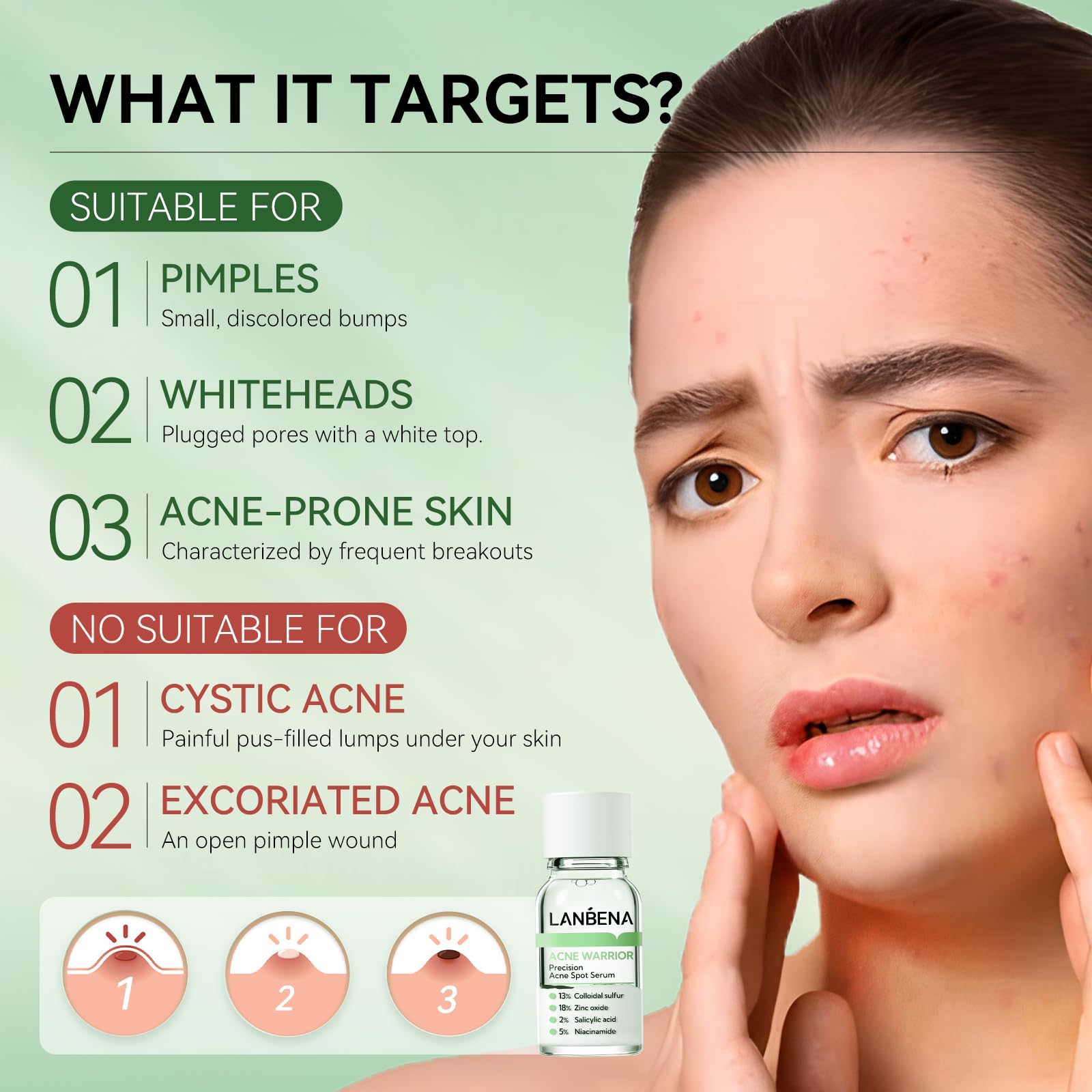 LANBENA Bamboo Charcoal Nose Pore Strips (1.03 Oz) & Acne Treatment Kit with Blackhead Remover & Pore Serum (0.42 Oz) - Deep Cleansing for Oily Skin, Blackhead Removal, Acne Care - Perfect for Daily Skincare Routine & Travel Essentials