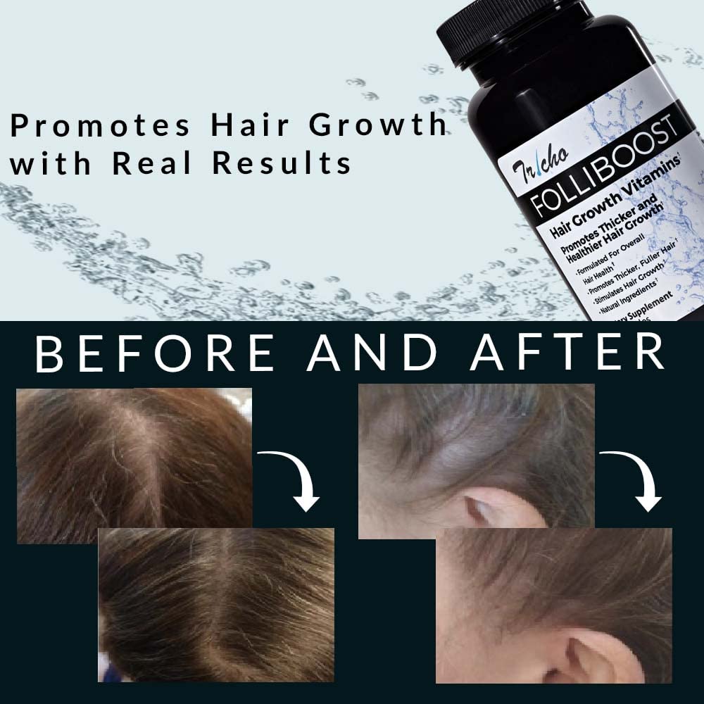 Tricho Hair Growth Vitamins with Biotin, Vitamin C, Zinc & B12 - Hair Care Supplement for Thicker, Fuller & Healthier Hair - 6 Month Supply - Perfect for Men & Women with Thinning Hair or Hair Loss Concerns