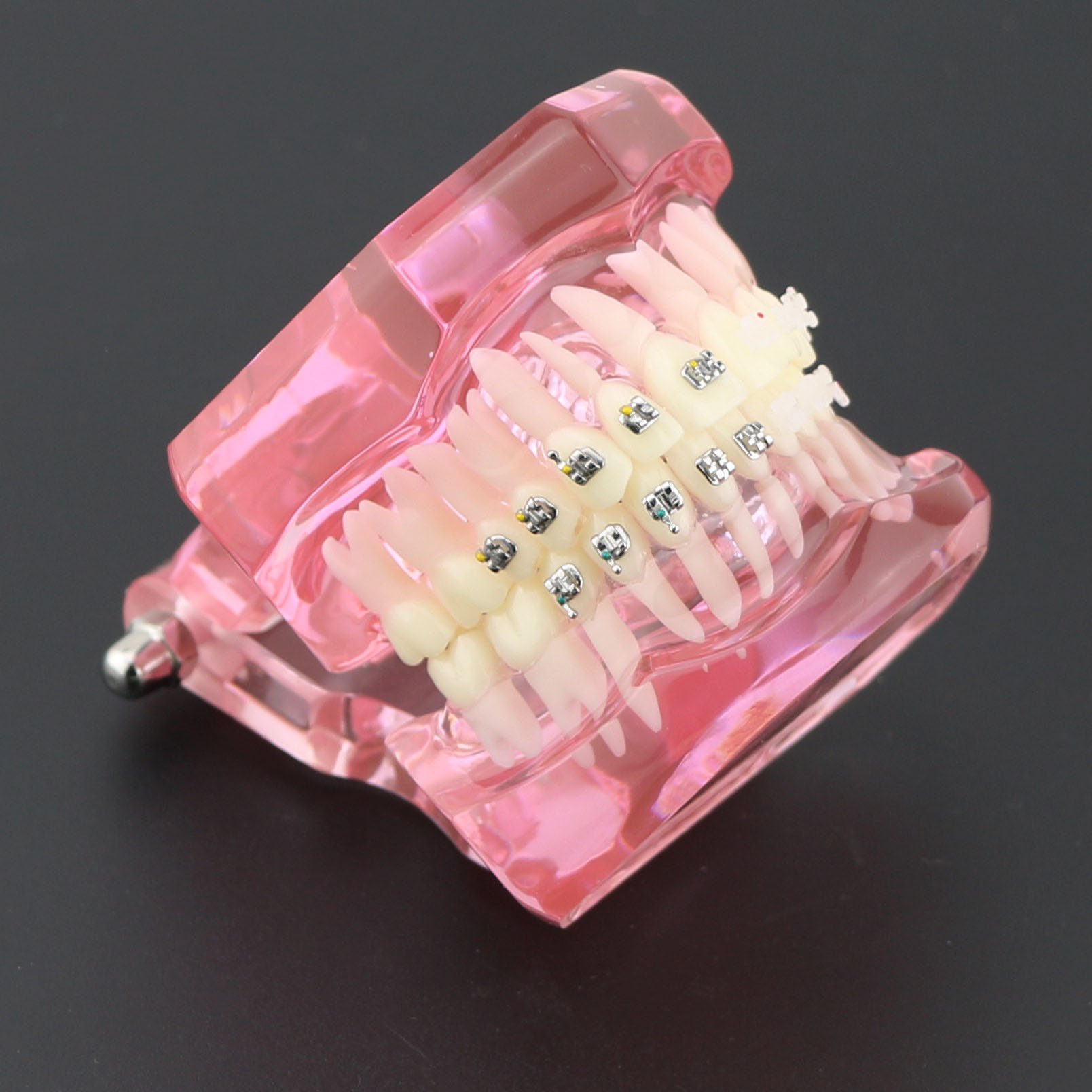 Dental Orthodontic Teeth Model with Metal & Ceramic Brackets - Professional Study Teeth Model for Dentists, Students & Orthodontic Training | Perfect for Dental Education, Practice & Office Display