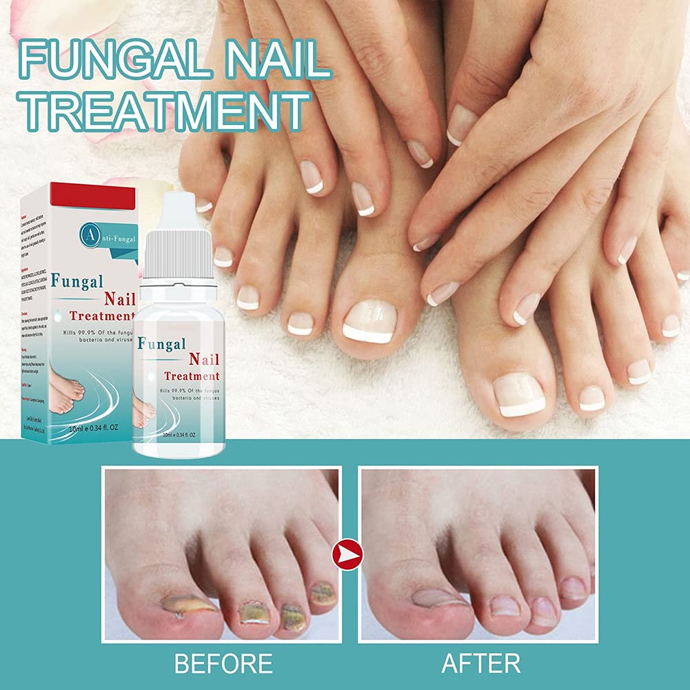 Extra Strong Nail Fungus Treatment - Repair Damaged Toenails for Men & Women - Perfect for Athletes & Daily Use