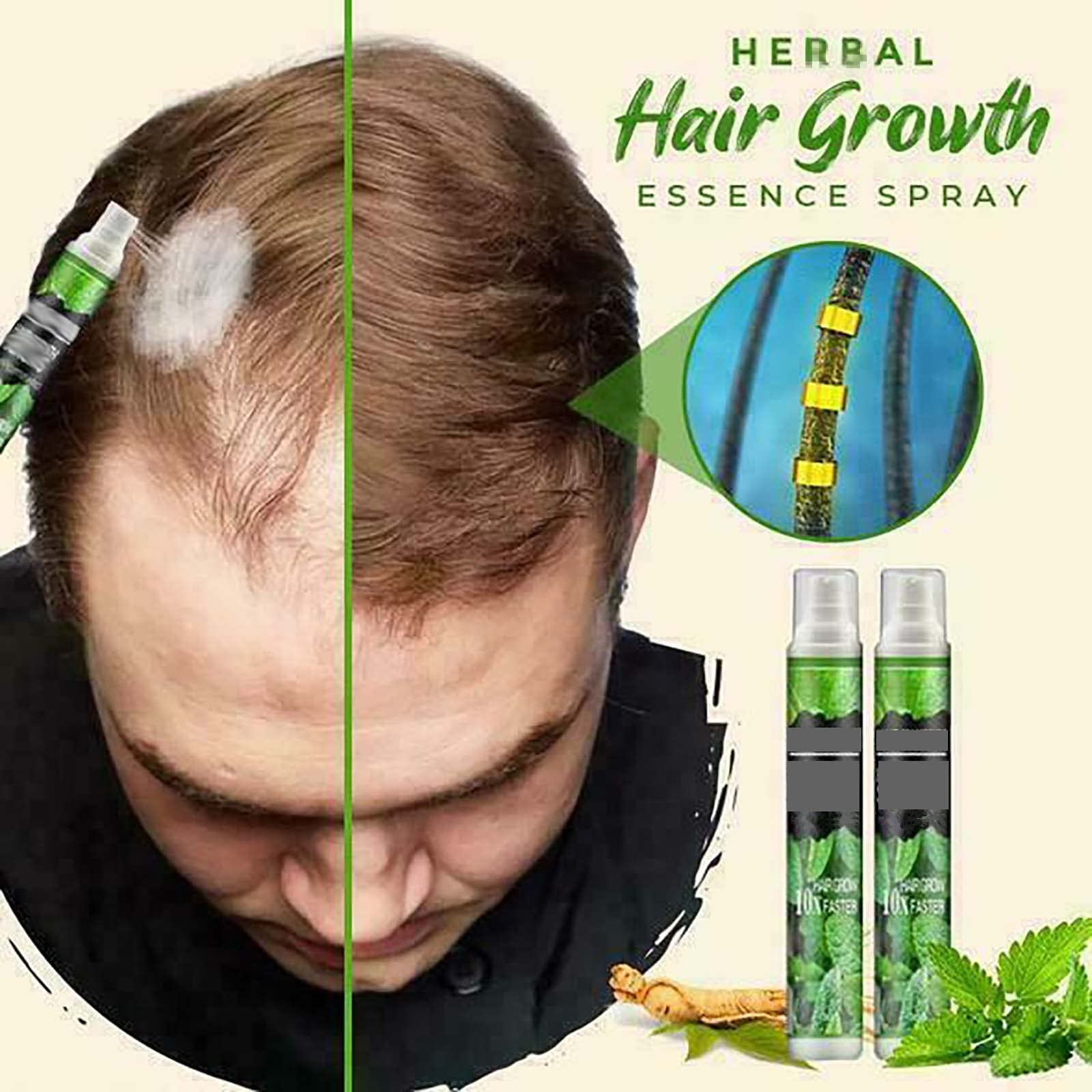 Natural Herbal Hair Growth Essence Spray - Prevent Postpartum Hair Loss & Stimulate Fast Growth | Anti-Hair Loss Serum for Dry Hair (3 Pack) | Perfect for Post-Pregnancy Care & Daily Hair Regimen