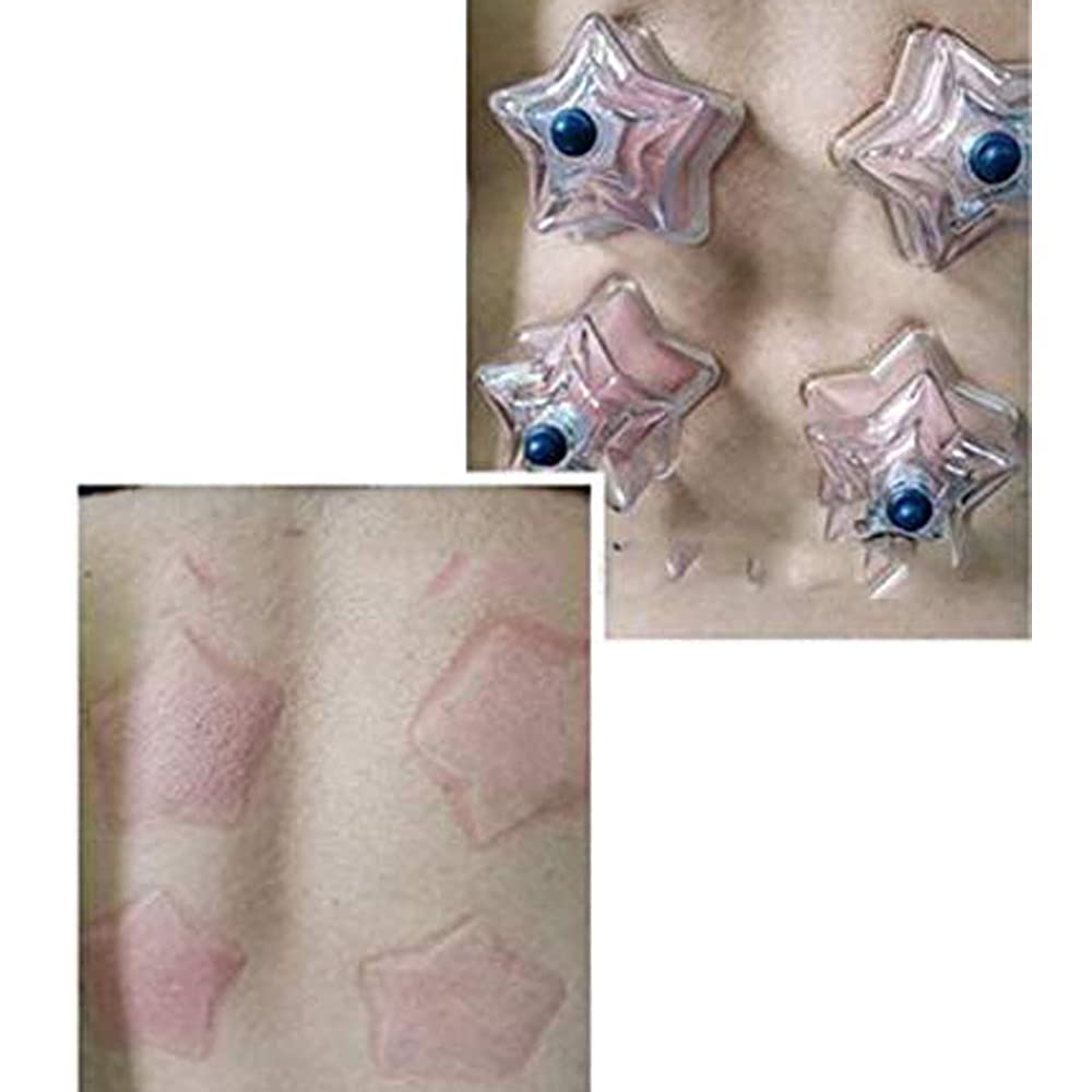 24PCS Star Shape Cupping Therapy Cups - Thickened Reusable Plastic Cupping Set for Pain Relief, Detox & Beauty - Perfect for Home Spa, Massage Therapy & Wellness Treatments