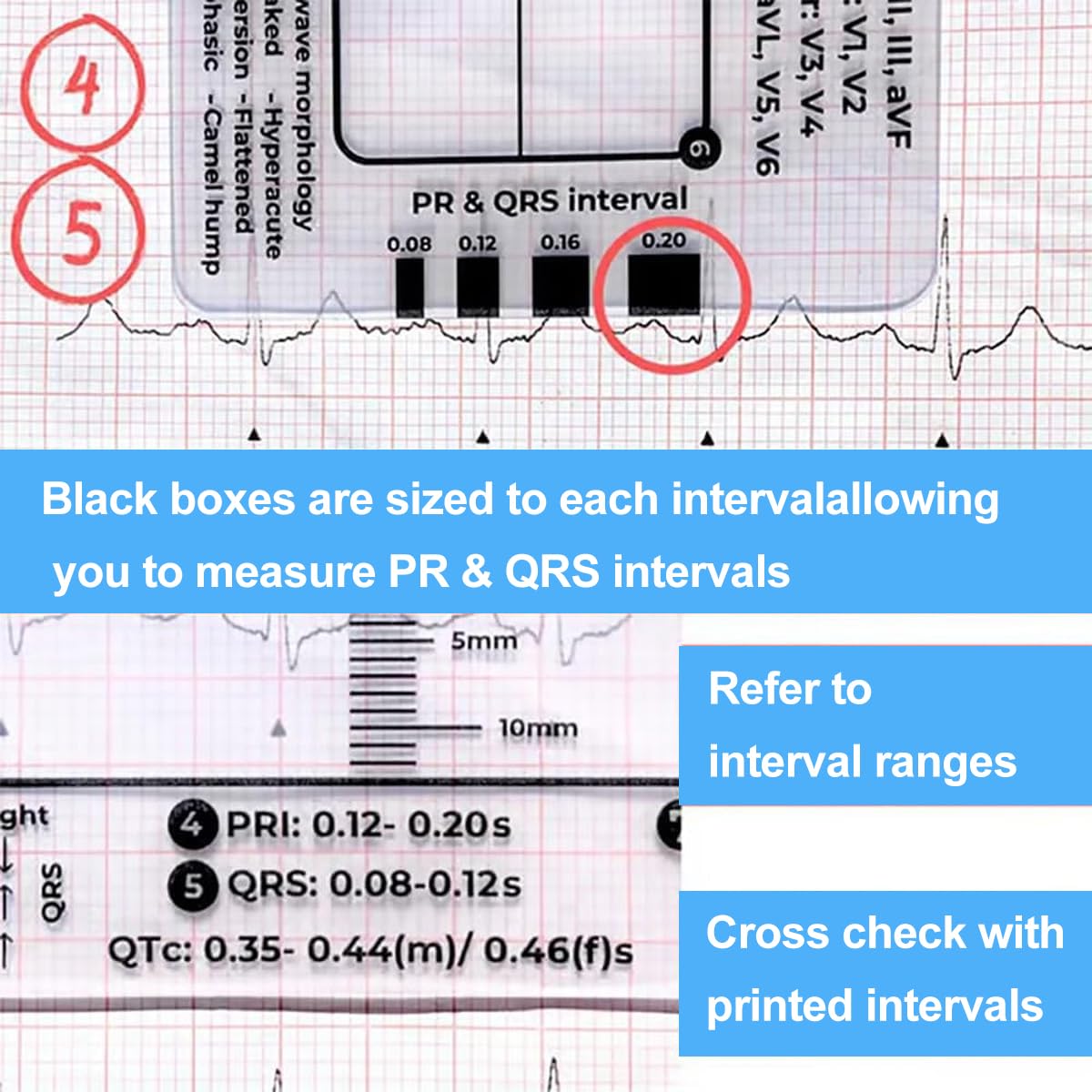 7-Step ECG Ruler for EKG Interpretation - Transparent Caliper Measuring Tool with Portable Assessment Card (2PCS) - Perfect for Medical Students, Nurses & Doctors for Heart Rate Monitoring & ECG Analysis