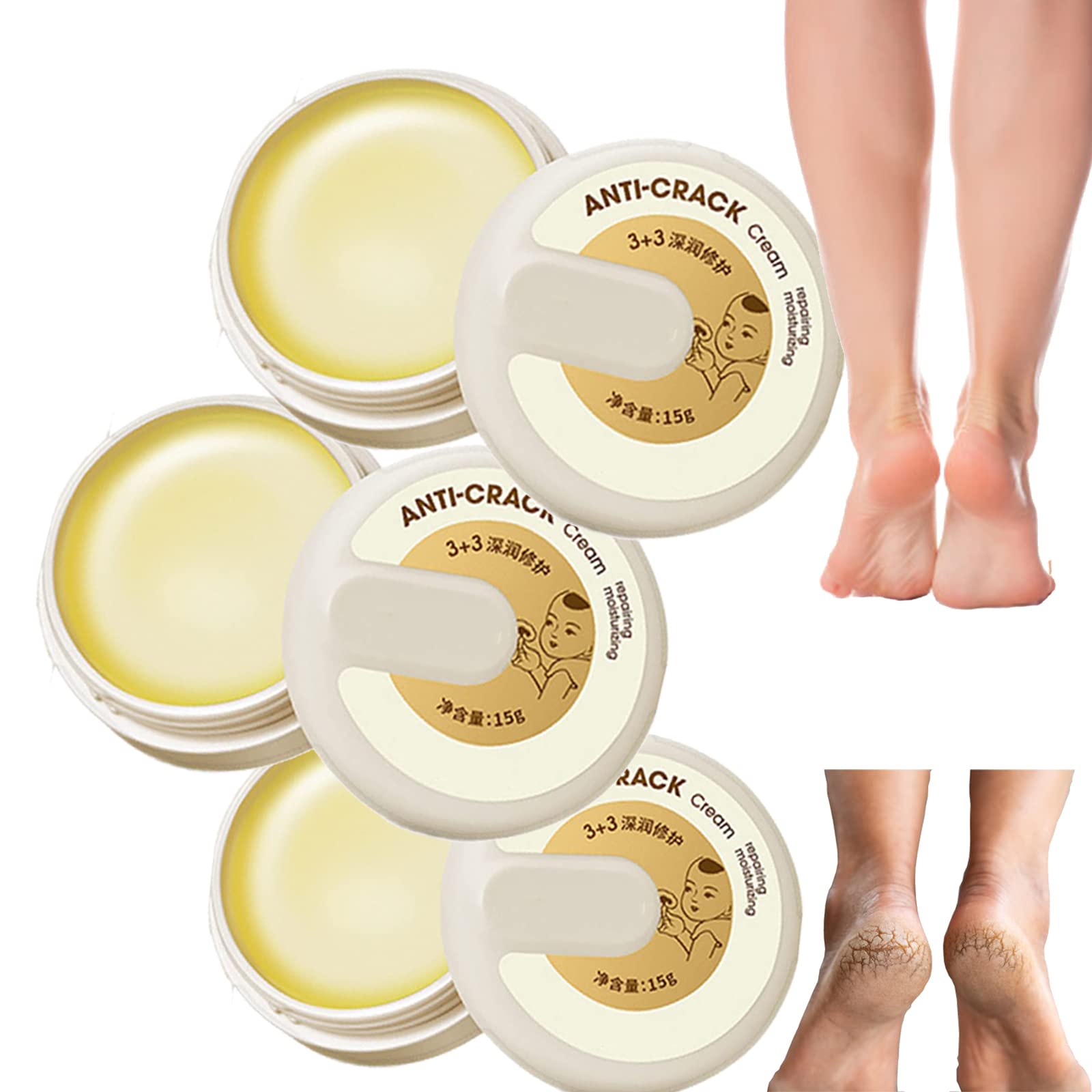 Best Winter Cracked Skin Repair Cream 2024 - Natural Anti Crack Hand & Foot Cream for Dry, Rough, Chapped Skin - Ultra Moisturizing Foot Balm (15g x 3pcs) - Perfect for Winter Care, Overnight Healing & Daily Hand Foot Protection