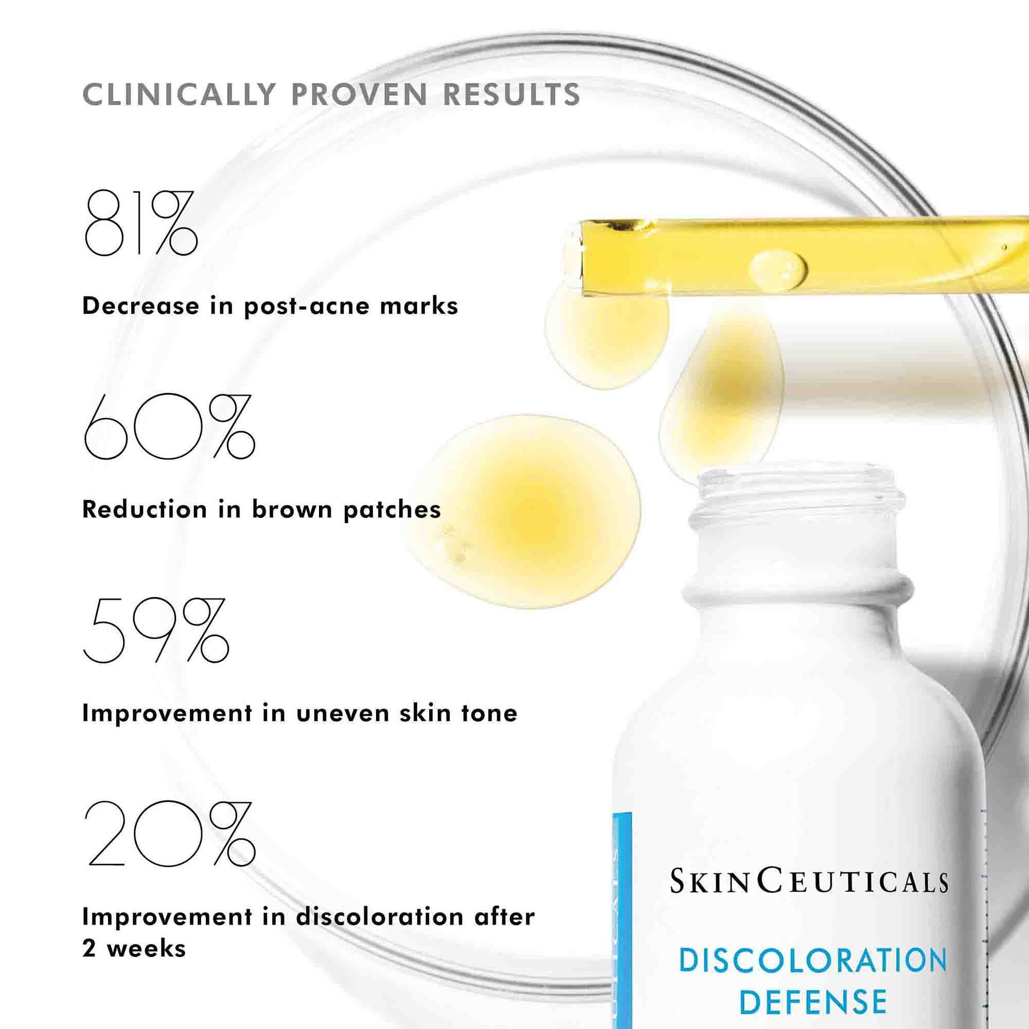 Discoloration Defense Serum - Brightening & Even Skin Tone Treatment for Hyperpigmentation & Dark Spots | Perfect for Daily Skincare & Anti-Aging Routine