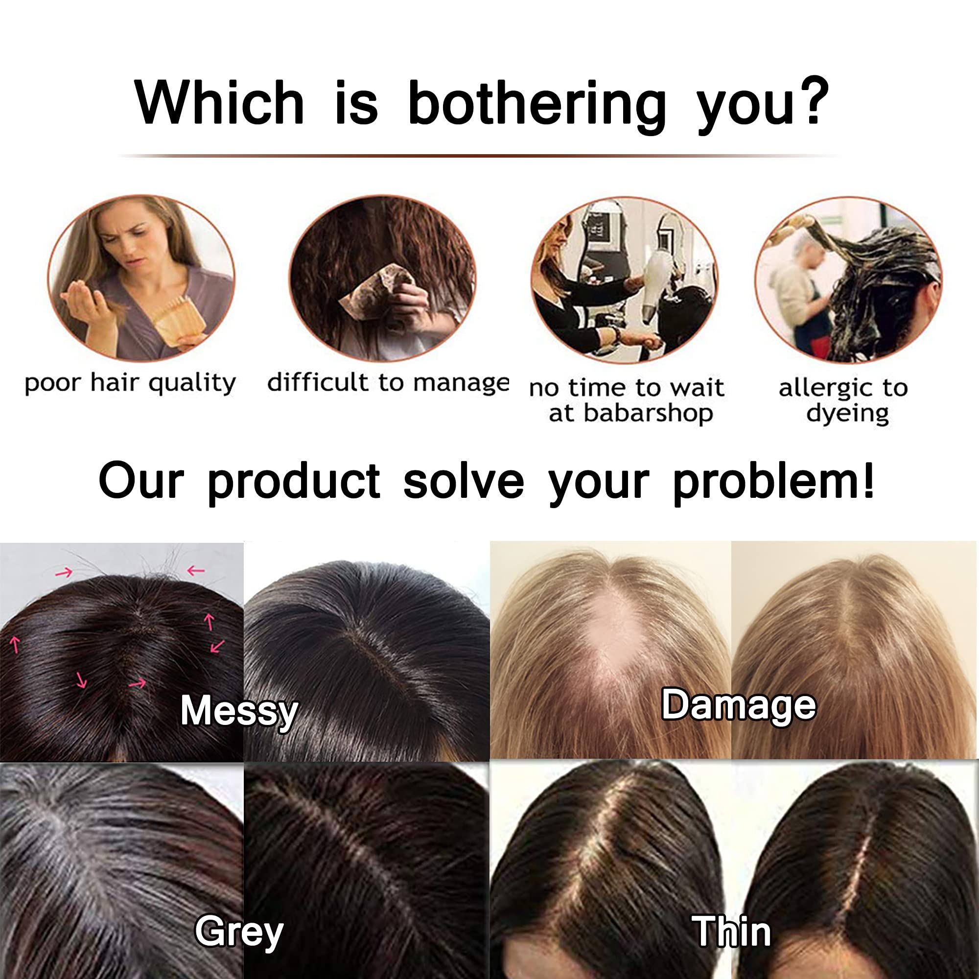 SEGO 130% Density Human Hair Toppers for Women - No Bangs, 10x12cm Silk Base, 100% Remy Clip-in Top Wiglet for Thinning Hair - 14 Inch Medium Brown & Dark Blonde - Perfect for Daily Wear, Parties & Hair Loss Solutions