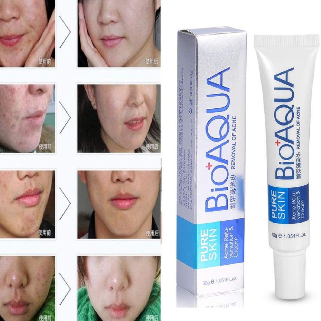 AquaBioaqua Acne Treatment Cream - Pimple & Scar Removal for Clear Skin | Face Care