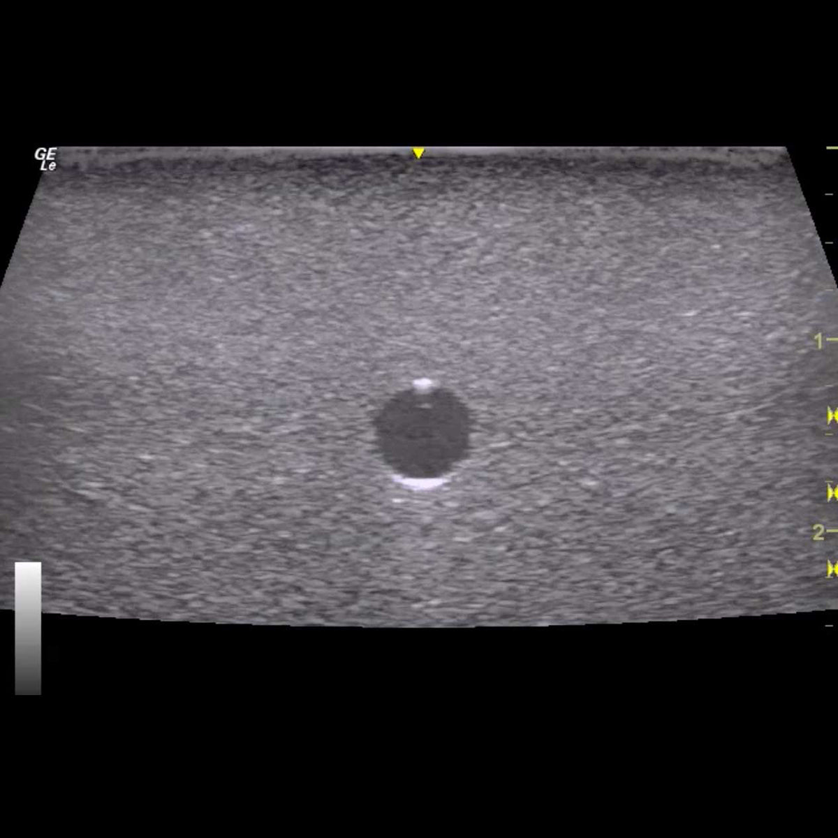 HM2.0 Remoldable 2-Vessel Ultrasound Training Model - Perfect for Medical Students & Sonography Practice (Arterial & Venous Vessel Simulation)
