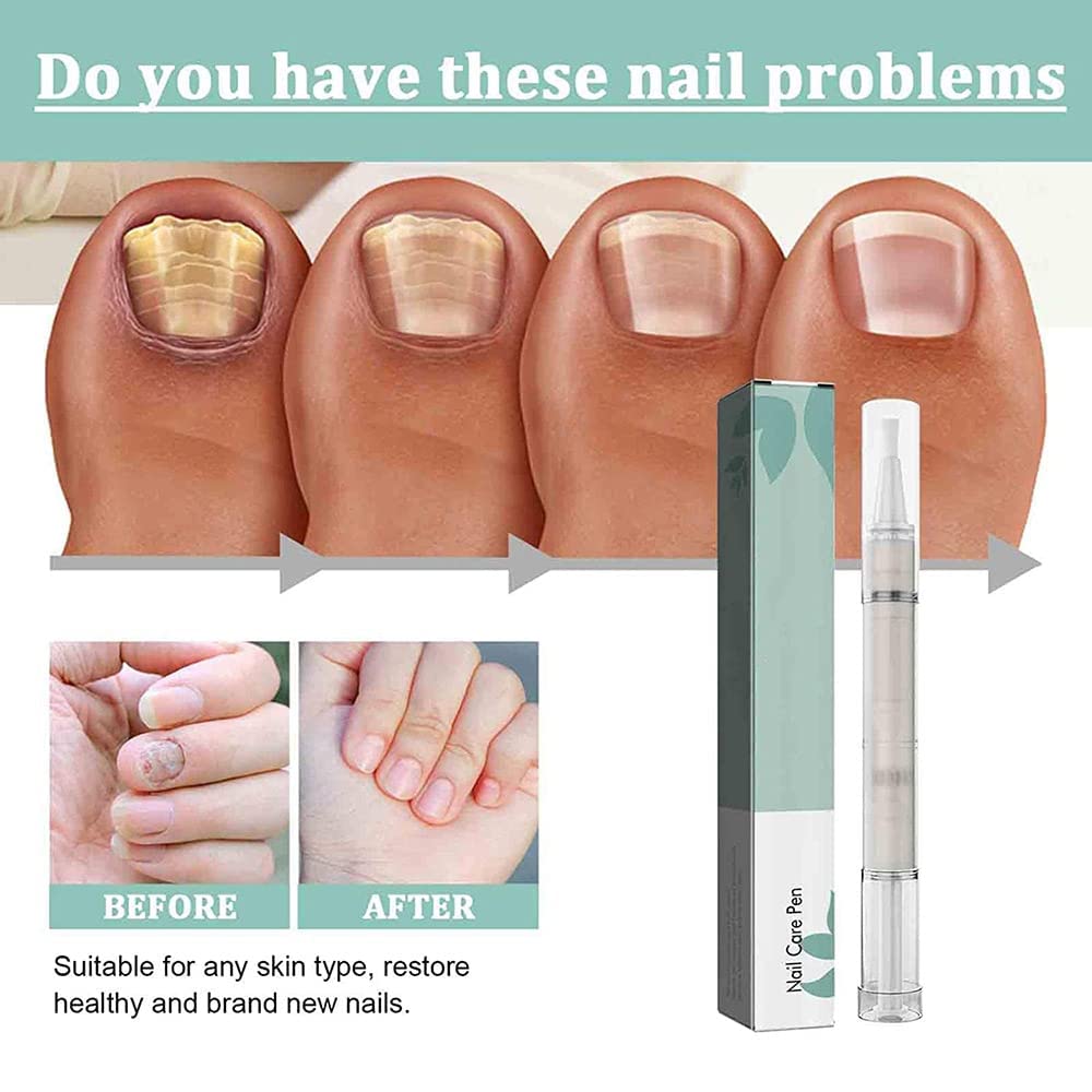 Nail Growth Serum & Repair Pen - Cuticle Oil Treatment for Toenail & Fingernails - Fungus Care & Damaged Nail Recovery (3 Pack) | Perfect for Home Manicures, Pedicures & Professional Salon Use