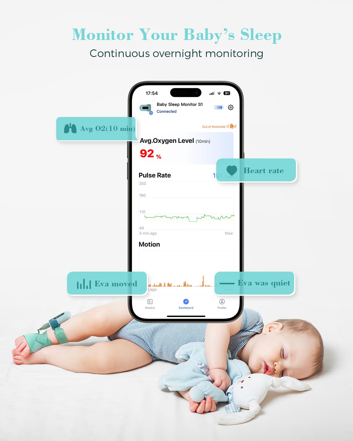 Babytone Baby Oxygen Monitor Sock - Track O2, Pulse & Movement for Infants 0-36M - Sleep Monitoring Wearable with Bluetooth App