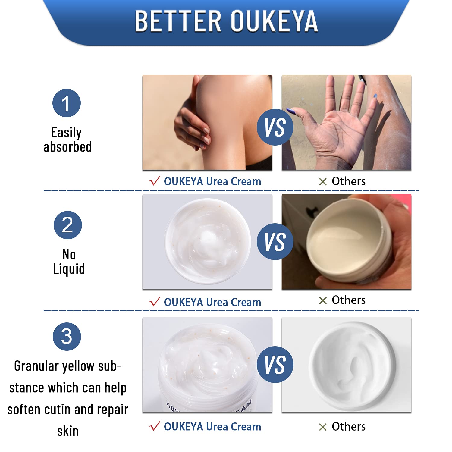 40% Urea Cream for Dry Cracked Hands & Feet - Maximum Strength Moisturizing Lotion for Callus Removal & Cracked Heel Repair (4 Pack) - Perfect for Pedicures, Foot Care & Winter Skin Protection