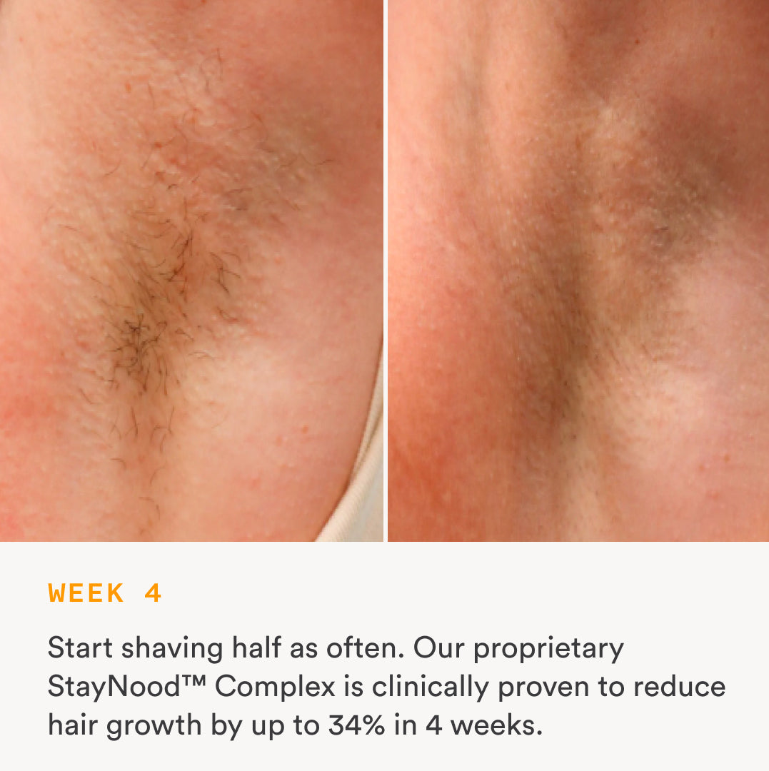 Nood Serum - Anti-Aging Face Serum with Hyaluronic Acid & Vitamin C for Glowing Skin | Perfect for Daily Skincare Routine & Nighttime Hydration