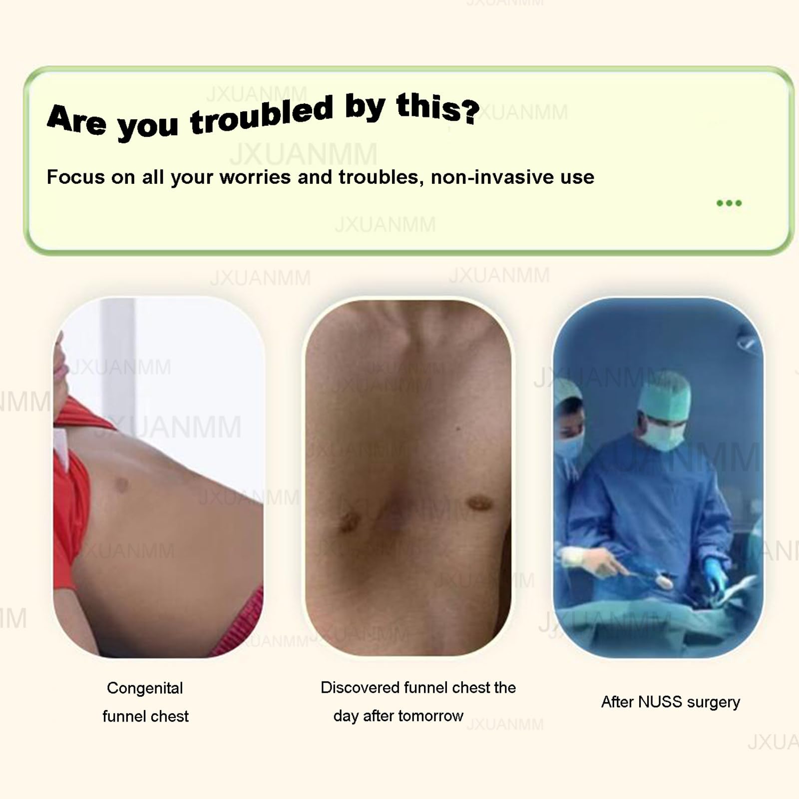 Pectus Excavatum Brace & Vacuum Bell - Adjustable Chest Support with Pressure Gauge for Pectus Carinatum Treatment - Ideal for Teens and Adults in Daily Activities & Sports