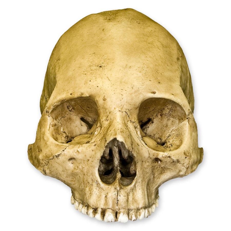 Authentic Replica Human Skull with Trephination - Perfect for Medical Study, Halloween Decor & Gothic Collectors