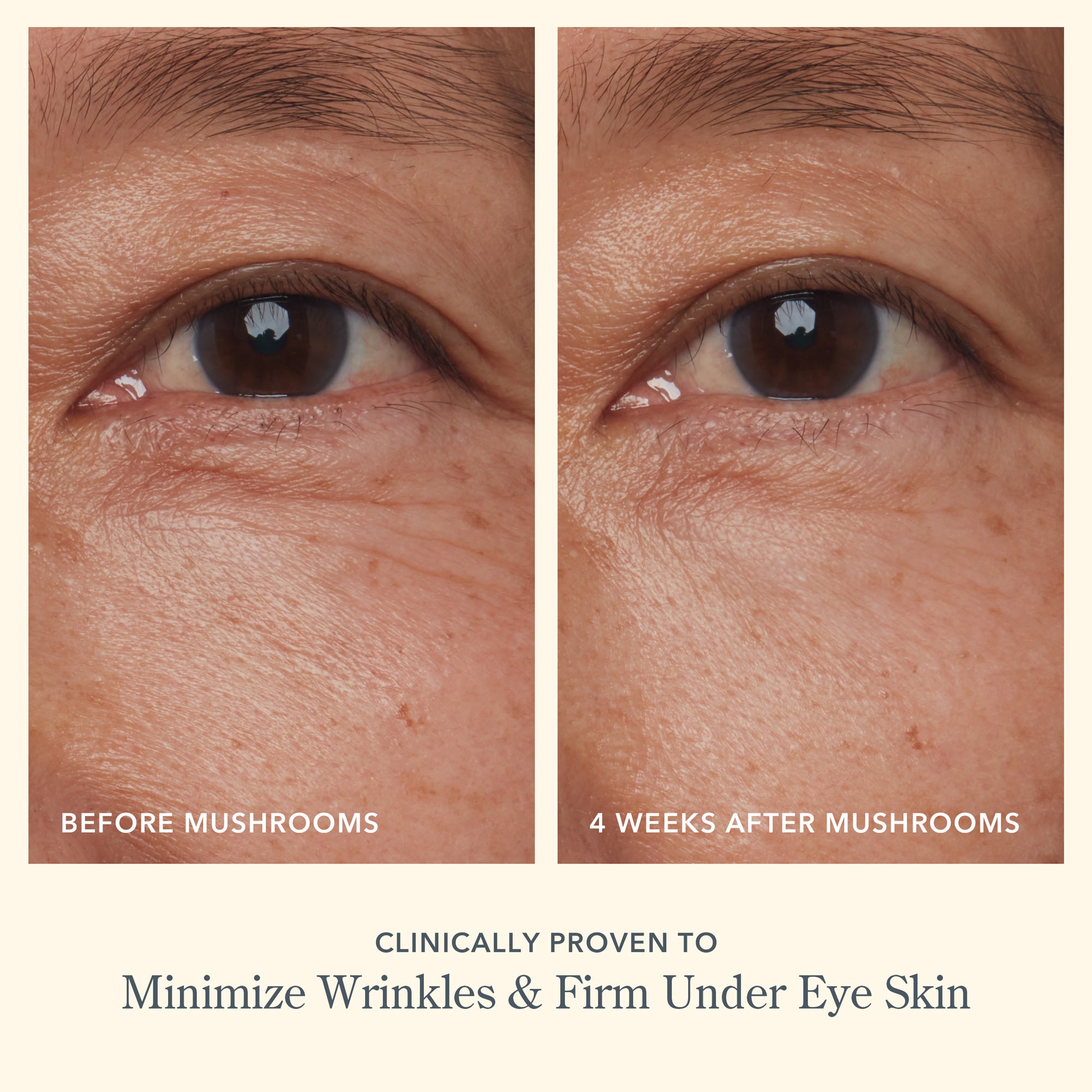 Best Anti-Aging Mushroom Milk Eye Cream for Dark Circles & Wrinkles - Hydrating & Firming Treatment for Day & Night Use
