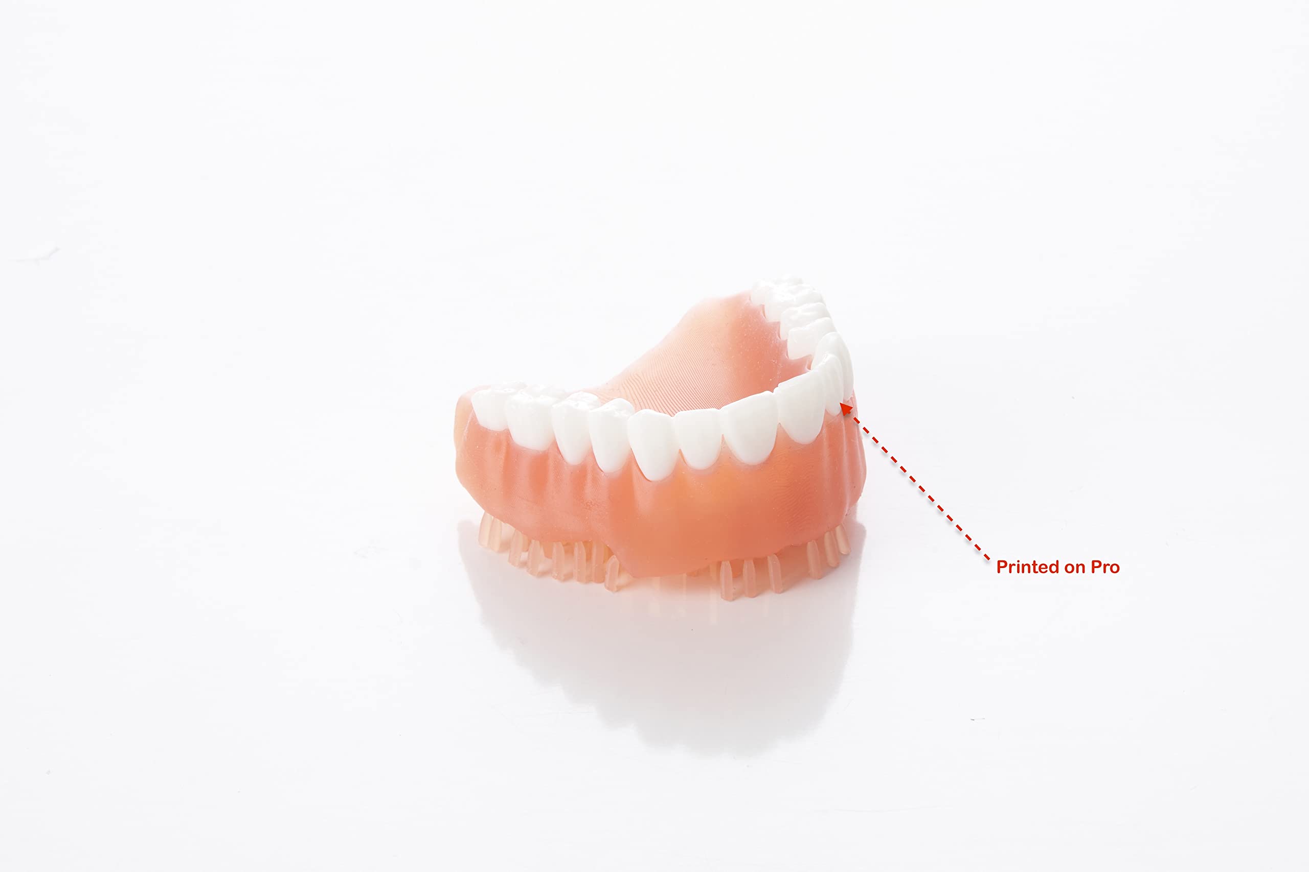 SprintRay Compatible DLP 3D Printer Resin - High Accuracy Modeling White V2 (1000g) with Excellent Mechanical Properties for Dental, Jewelry & Prototyping Applications