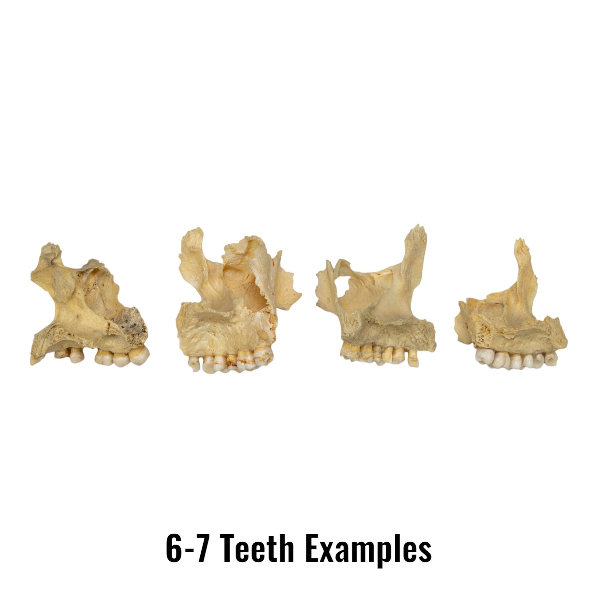 Authentic Human Maxillary Bone - Single Specimen for Medical Study, Dental Education, and Anatomy Research | Ideal for Students, Doctors, and Science Enthusiasts