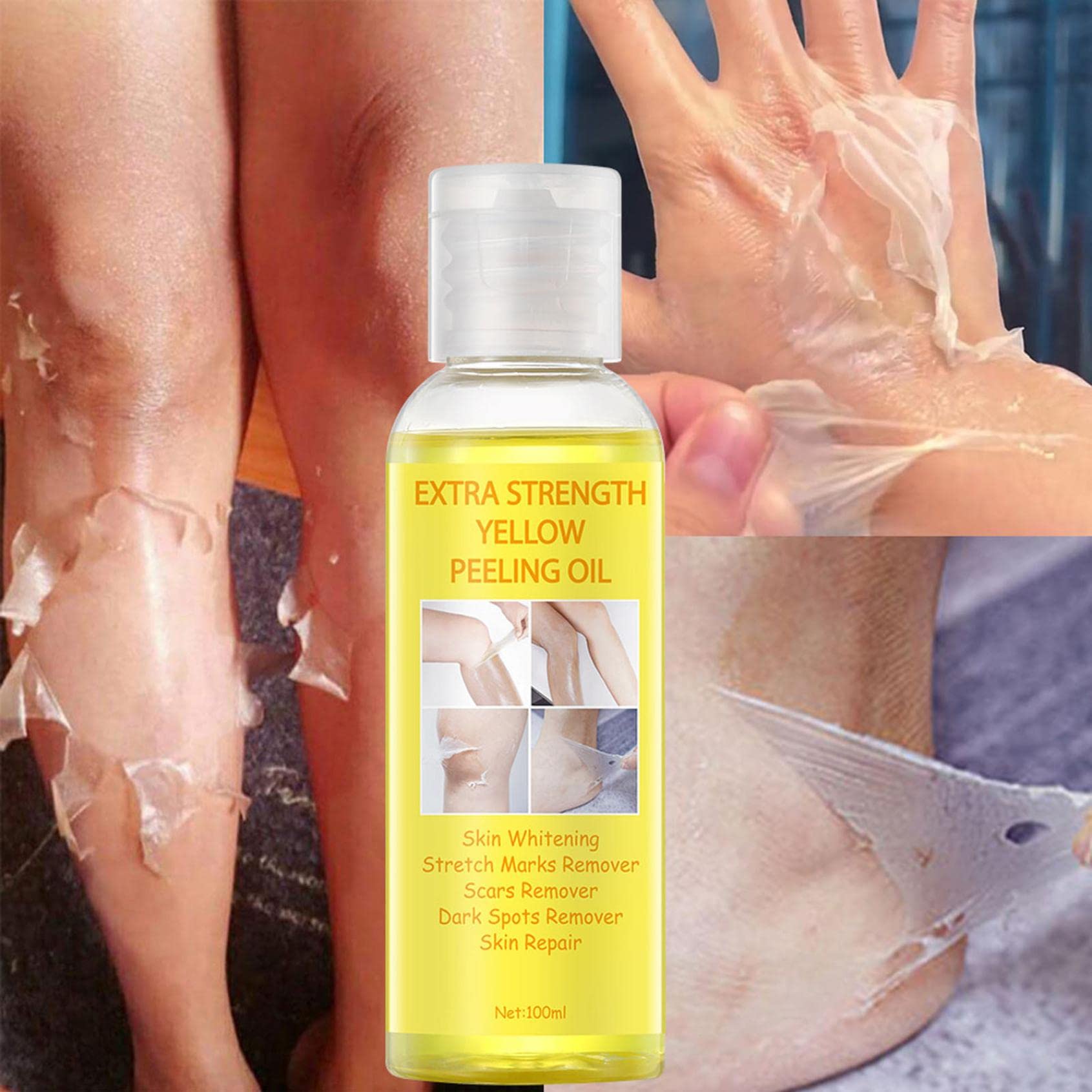 Natural Whitening & Exfoliating Body Peeling Oil for Dark Skin - Extra Strength Spot Treatment for Even Skin Tone | Perfect for Post-Tanning Care & Daily Skincare Routine