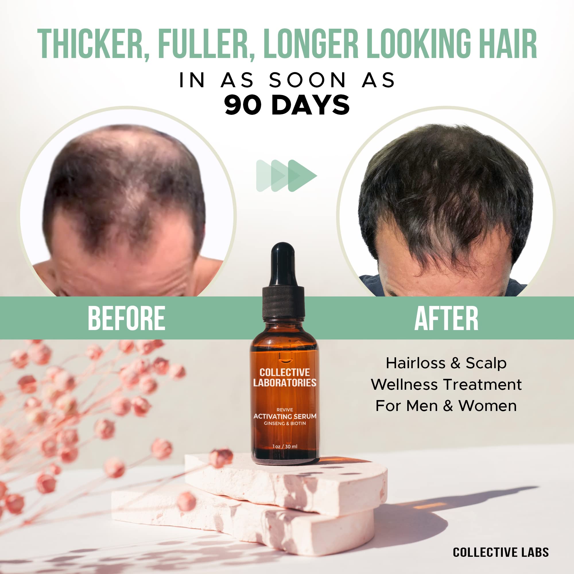 Collective Laboratories Hair Growth Serum - Scalp Treatment Oil for Thinning Hair & Hair Loss with Amino Acids, Minerals & Botanicals | Stimulates Hair Regrowth for Men & Women | Daily Use for Thicker, Fuller Hair