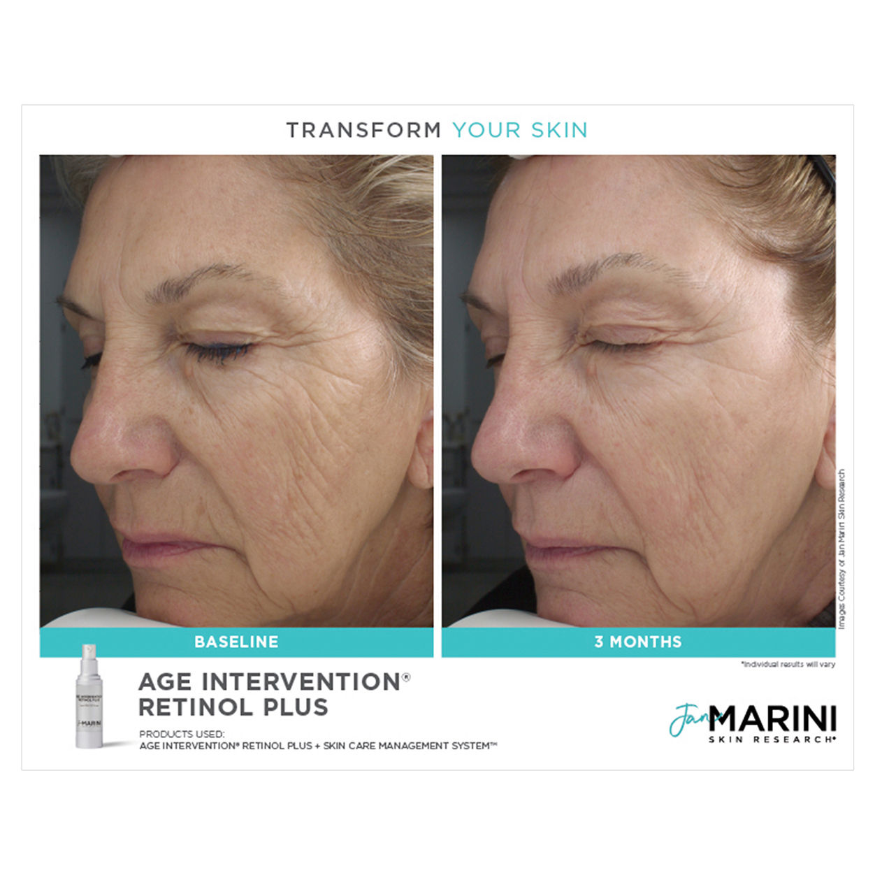 Age Intervention Retinol Plus Anti-Aging Serum - Reduce Wrinkles & Fine Lines | Night Face Treatment for Youthful Skin | Perfect for Daily Skincare Routine & Anti-Aging Regimen