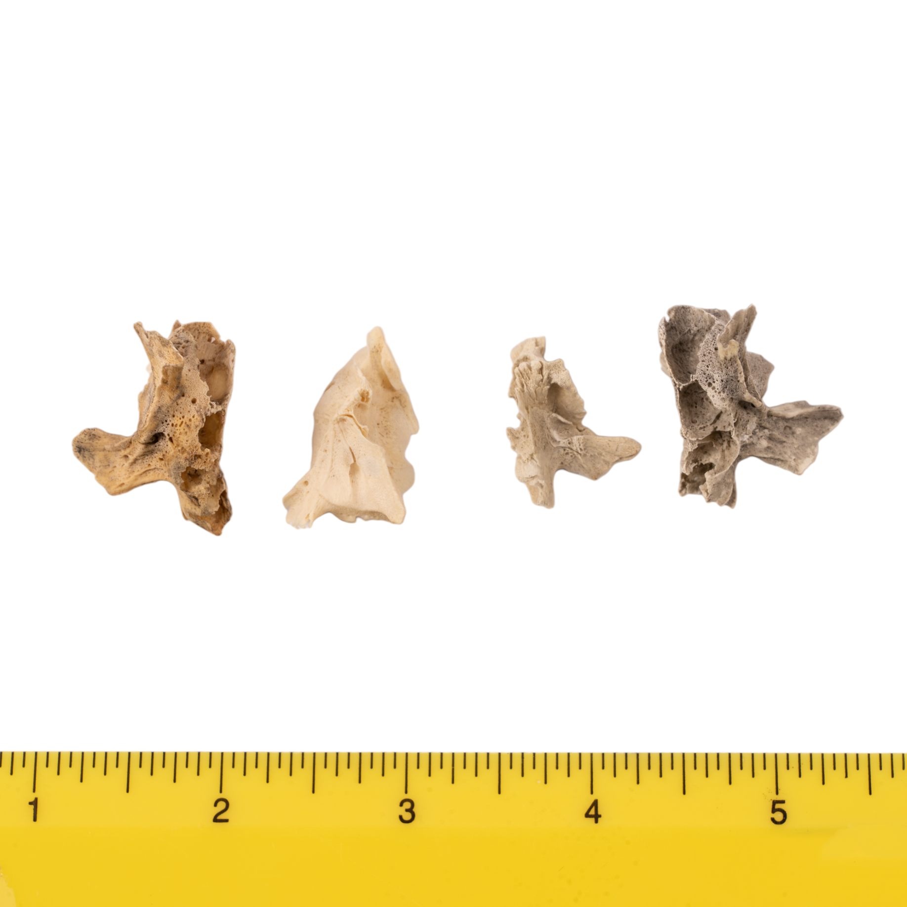 Premium Human Fetal Half Maxilla Specimen for Medical Research - High-Quality Anatomical Study Material for Dental, Craniofacial, and Developmental Biology Research (Ideal for Universities, Labs, and Medical Training)