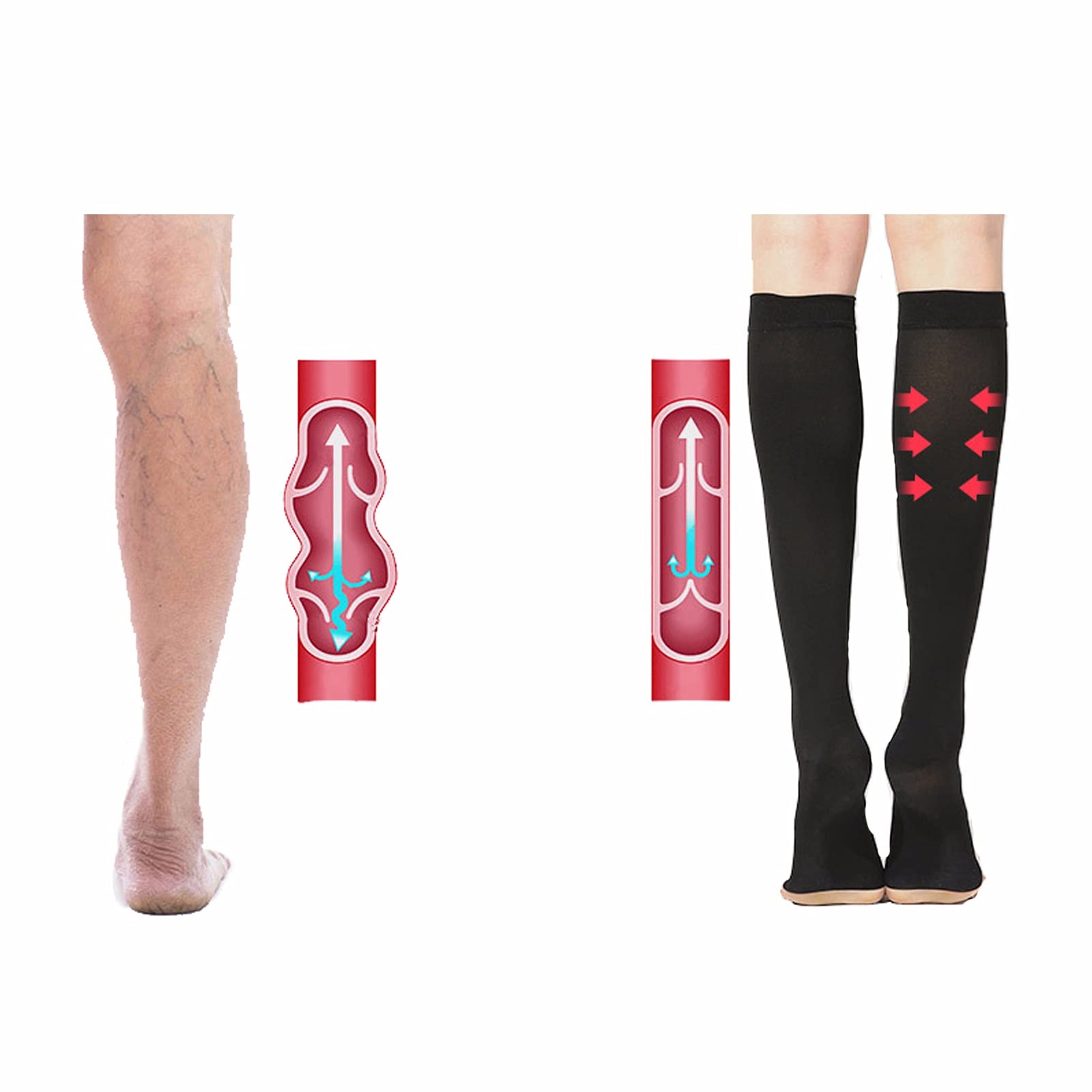 23-32mmHg Gradient Compression Stockings for Swelling & Circulation - XXL Size for Plus Size & Post-Liposuction Recovery - Ideal for Travel, Pregnancy & Varicose Vein Relief