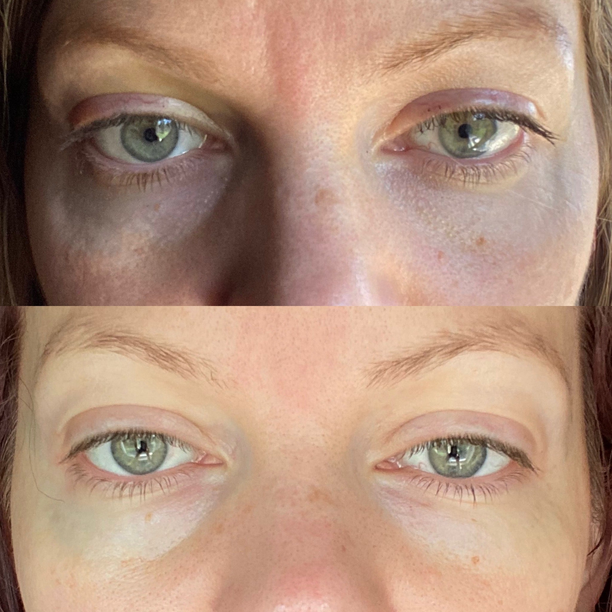 Deep Repair Eye Serum for Dark Circles & Wrinkles - Anti-Aging Eye Treatment with Hyaluronic Acid & Vitamin C - Perfect for Night & Day Use