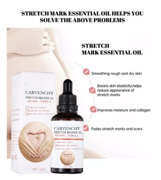 Ramley Stretch Marks Oil for Women - 30ML | Pregnancy Safe, Deep Moisturizing & Skin Repair for Radiant Look | Perfect for Pre & Postpartum Care, Daily Hydration & Stretch Mark Prevention