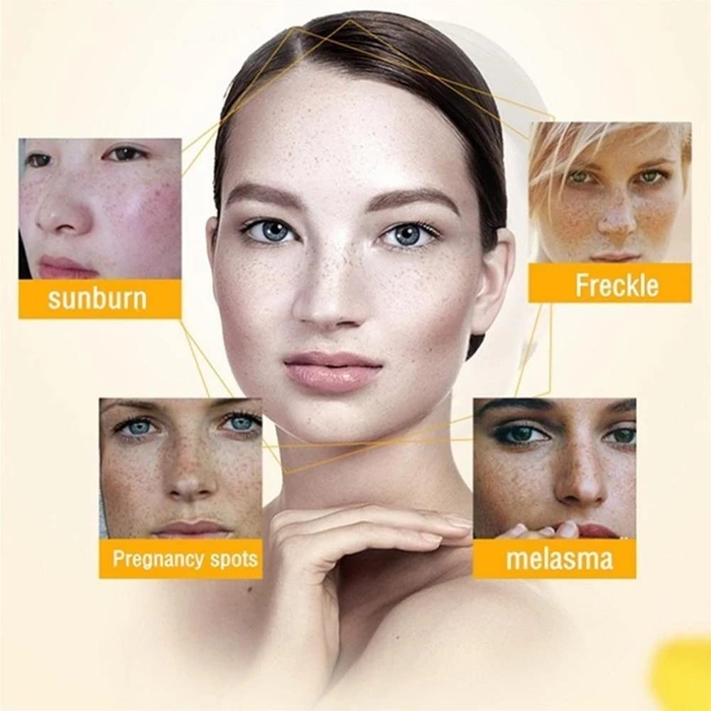 Plant-Based Melanin Freckle Lightening Cream - Dark Spot Corrector & Skin Whitening Treatment for Face (2pc) | Brightens Complexion, Reduces Freckles & Hyperpigmentation | Perfect for Daily Skincare Routine & Evening Skin Tone