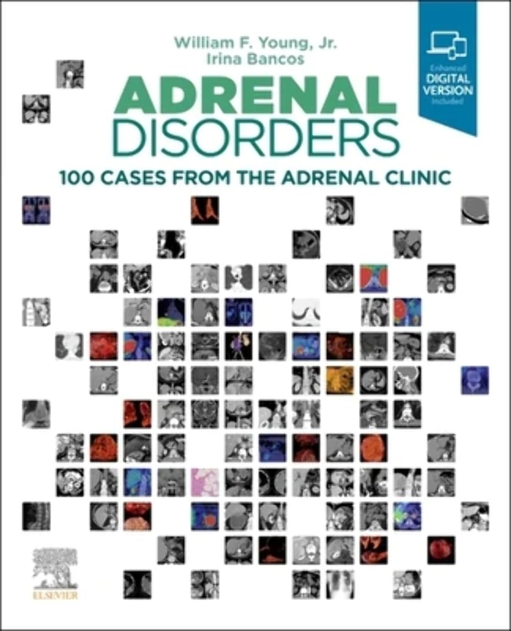 Adrenal Disorders: 100 Clinical Case Studies for Diagnosis & Treatment - Essential Guide for Endocrinologists & Medical Professionals