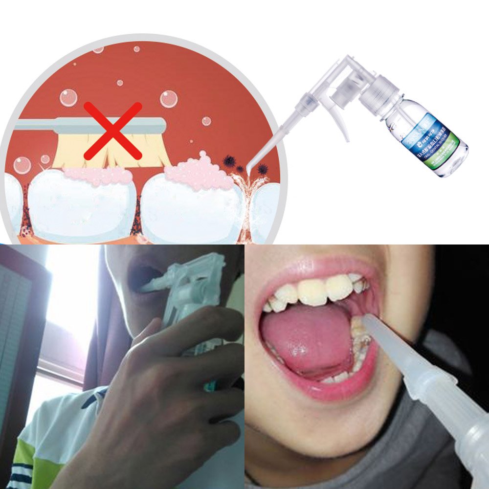Portable Dental Water Flosser for Teeth Cleaning - Oral Irrigator with Fresh Breath Rinse & Tonsil Stone Remover - Perfect for Travel, Home and Office Use