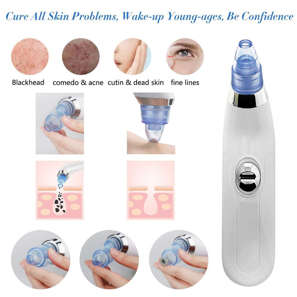 Vyoma Electric Blackhead & Pimple Remover - Acne Vacuum Suction Tool for Nose & Face | Microdermabrasion Pore Cleaner Device | Perfect for Daily Skincare & Spa Treatments