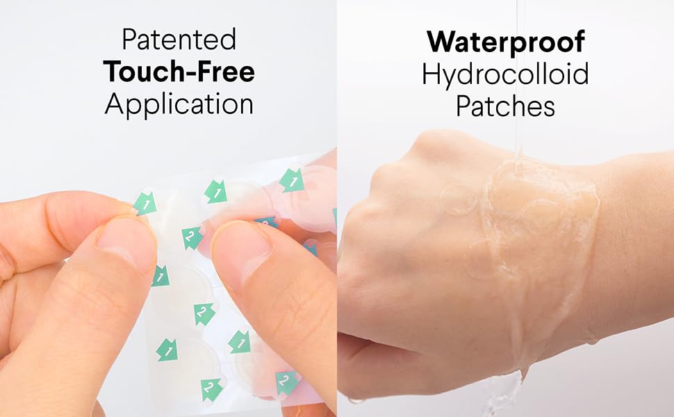 75 Acne Pimple Patches - Natural Calming 10mm Spot Treatment for Clear Skin | Easy & Clean Innovative Hydrocolloid Patches for Face | Perfect for Overnight Use, Travel & Daily Skincare Routine